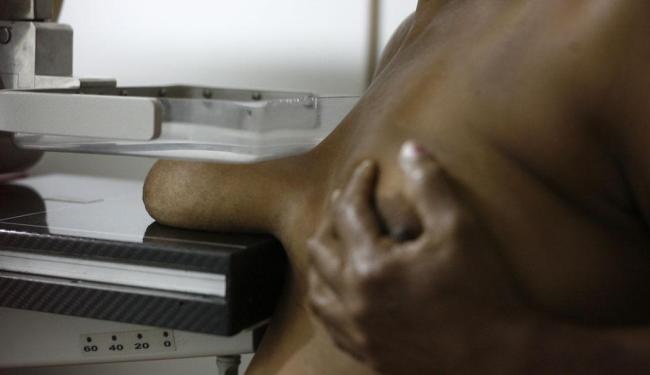 Estudos afirmam que mulheres de 50 a 69 anos são as que mais se beneficiam da mamografia - Foto: Raul Spinassé | Ag. A TARDE