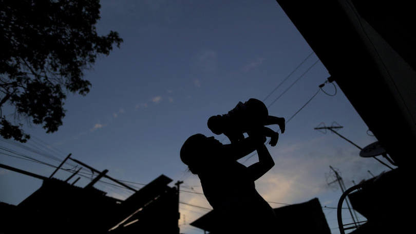 bebe-com-microcefalia-causada-pelo-zika-virus-no-colo-da-mae